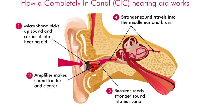How A CIC Hearing Aid Works